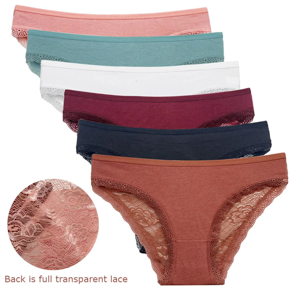 Δαντελένια Lace Σετ 5 Τεμαχίων – Αισθητικά & Άνεση