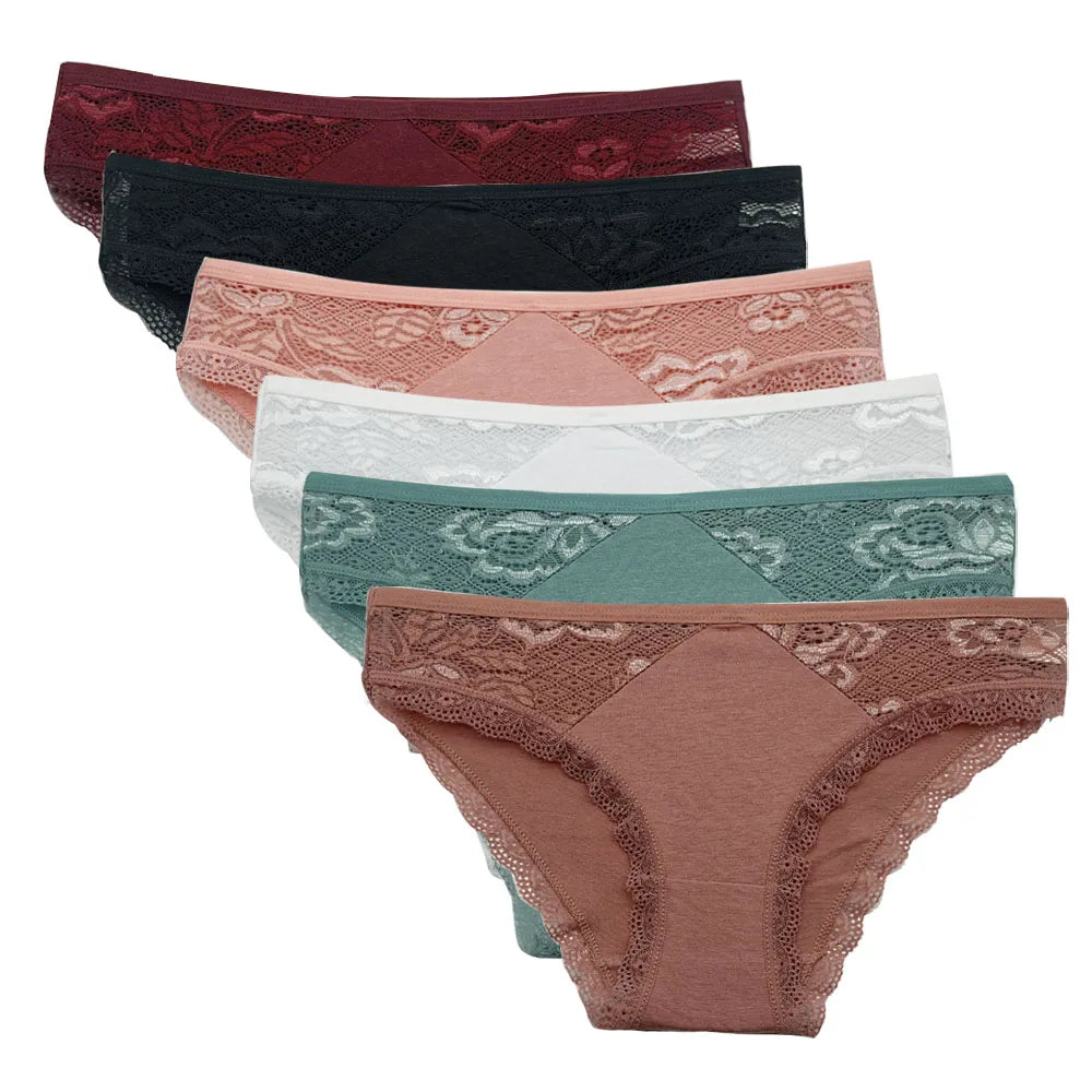 Δαντελένια Lace Σετ 5 Τεμαχίων – Αισθητικά & Άνεση