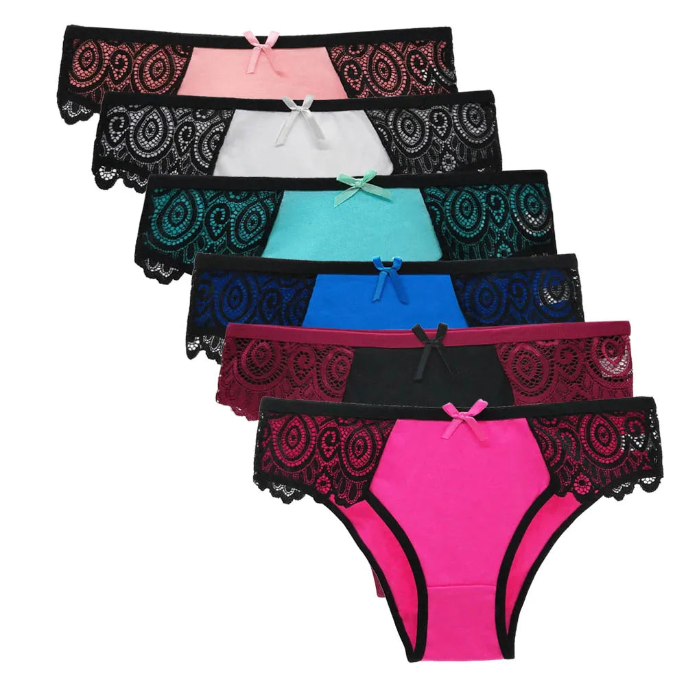 Δαντελένια Lace Σετ 5 Τεμαχίων – Αισθητικά & Άνεση