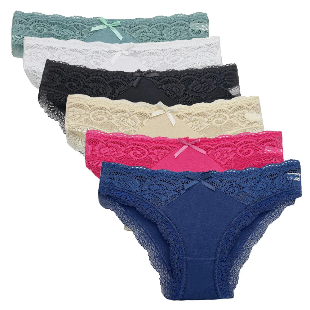 Δαντελένια Lace Σετ 5 Τεμαχίων – Αισθητικά & Άνεση