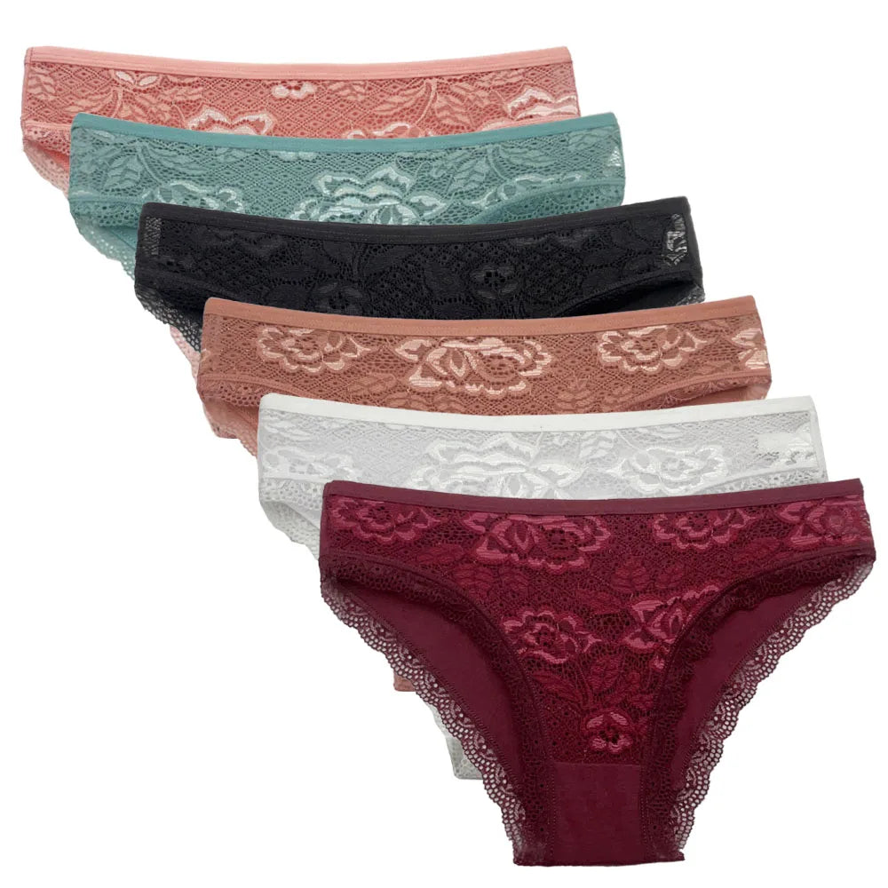 Δαντελένια Lace Σετ 5 Τεμαχίων – Αισθητικά & Άνεση